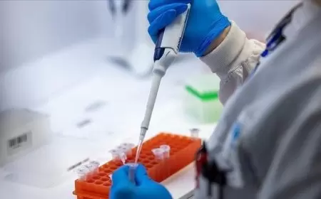 بريطانيا تكتشف أول إصابة بشرية بسلالة "إنفلونزا الخنازير" الجديدة