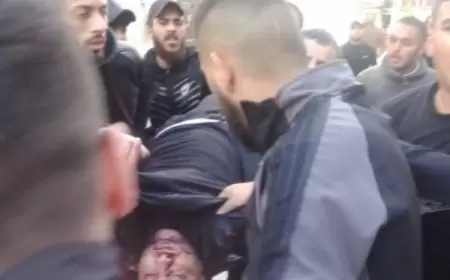 4 اصابات- اشتباكات خلال اقتحام جيش الاحتلال مخيم بلاطة