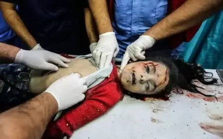 استشهاد 18 مواطنًا في قصف إسرائيلي أمام مستشفى الأمل في خان يونس