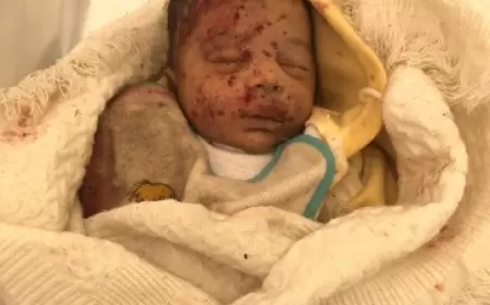 أطباء بلا حدود: لا أحد ولا مكان آمنا في غزة