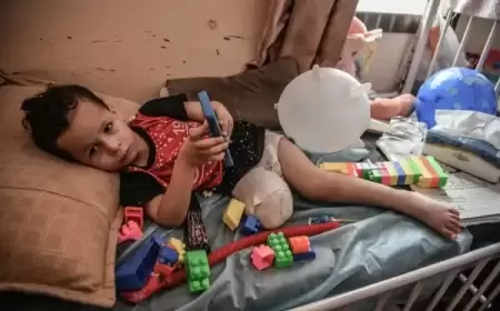 "إنقاذ الطفولة": نحو 10 أطفال يفقدون سيقانهم يوميا بغزة