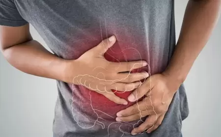 هل أرهقتك نوبات القولون العصبي؟ إليك أكلات ومشروبات تريحك