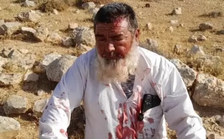 مستعمرون يعتدون بالضرب على مواطن في مسافر يطا جنوب الخليل