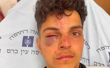 مستوطنون يعتدون على شاب في القدس المحتلة