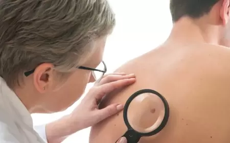 تقرير للبحرية الأميركية يكشف مفاجأة عن علاقة أشعة الشمس بسرطان الجلد