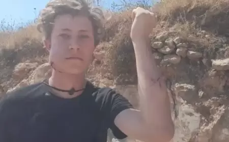 إصابة مواطن ومتضامن أجنبي في اعتداء للمستوطنين جنوب نابلس