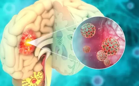 اكتشاف مذهل.. بكتيريا قد "تذيب" سرطان الرأس والعنق!