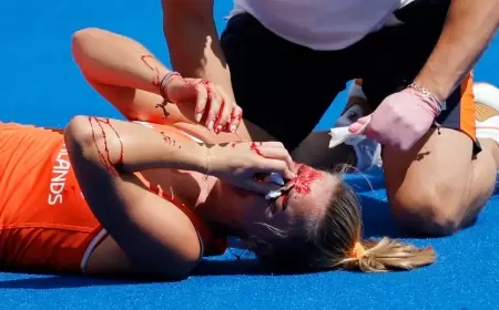 إصابة مروعة.. الدماء تغطي وجه لاعبة هولندية في أولمبياد باريس