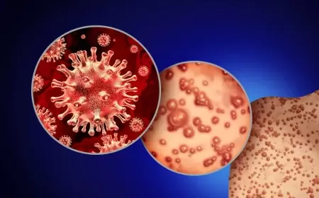 أعلى تحذير تطلقه منظمة الصحة العالمية بشأن جدري القردة