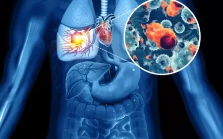 اختباراته نجحت مع 8 مرضى.. لقاح جديد يدمر خلايا السرطانات الصعبة