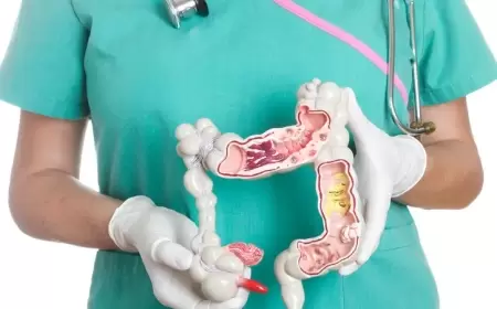 هل تعاني من القولون العصبي؟ إليك الطريقة لتخفيف الأعراض