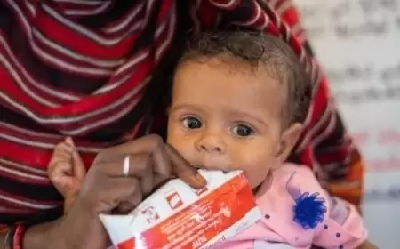 السودان: سوء التغذية يفتك بأرواح الأطفال