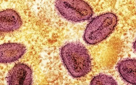 السلطات الصحية البريطانية تحقق في إصابة بفيروس «إمبوكس»