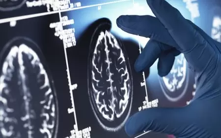 أوروبا توافق على أول دواء يستهدف السبب الجذري لمرض ألزهايمر