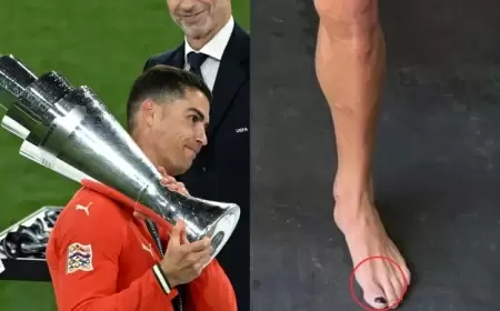 طلاء أظافر رونالدو يثير الاستغراب.. والسبب "فائدة صحية"