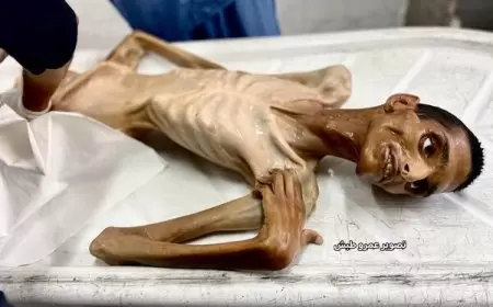 استشهاد شاب نتيجة سوء التغذية والمجاعة بغزة