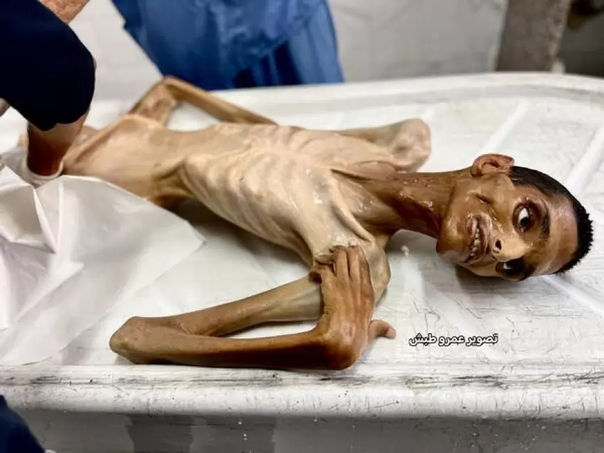 استشهاد شاب نتيجة سوء التغذية والمجاعة بغزة