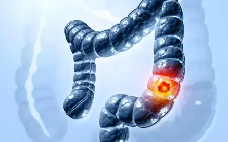 النشا المقاوم.. أطعمة بسيطة قد تقلل خطر السرطان لحد كبير