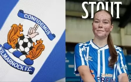 لاعبة شابة تتعرض للتنمر بسبب "حب الشباب".. والنادي يسحب إعلانه